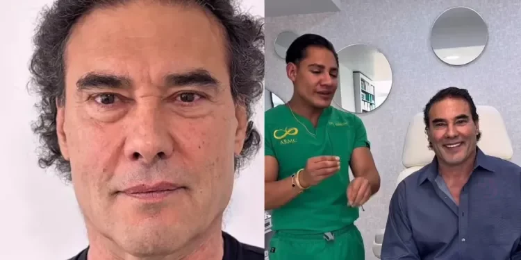 Eduardo Yáñez sorprende con nuevo rostro tras tratamiento estético