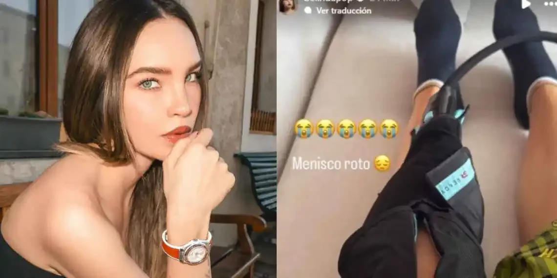 Belinda revela lesión en la rodilla y preocupa a sus seguidores: ¿Cuál es su estado de salud?