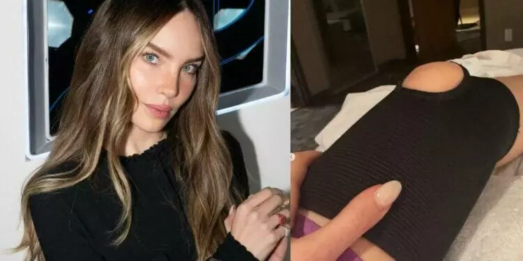 Belinda revela que fue hospitalizada por lesión en la rodilla